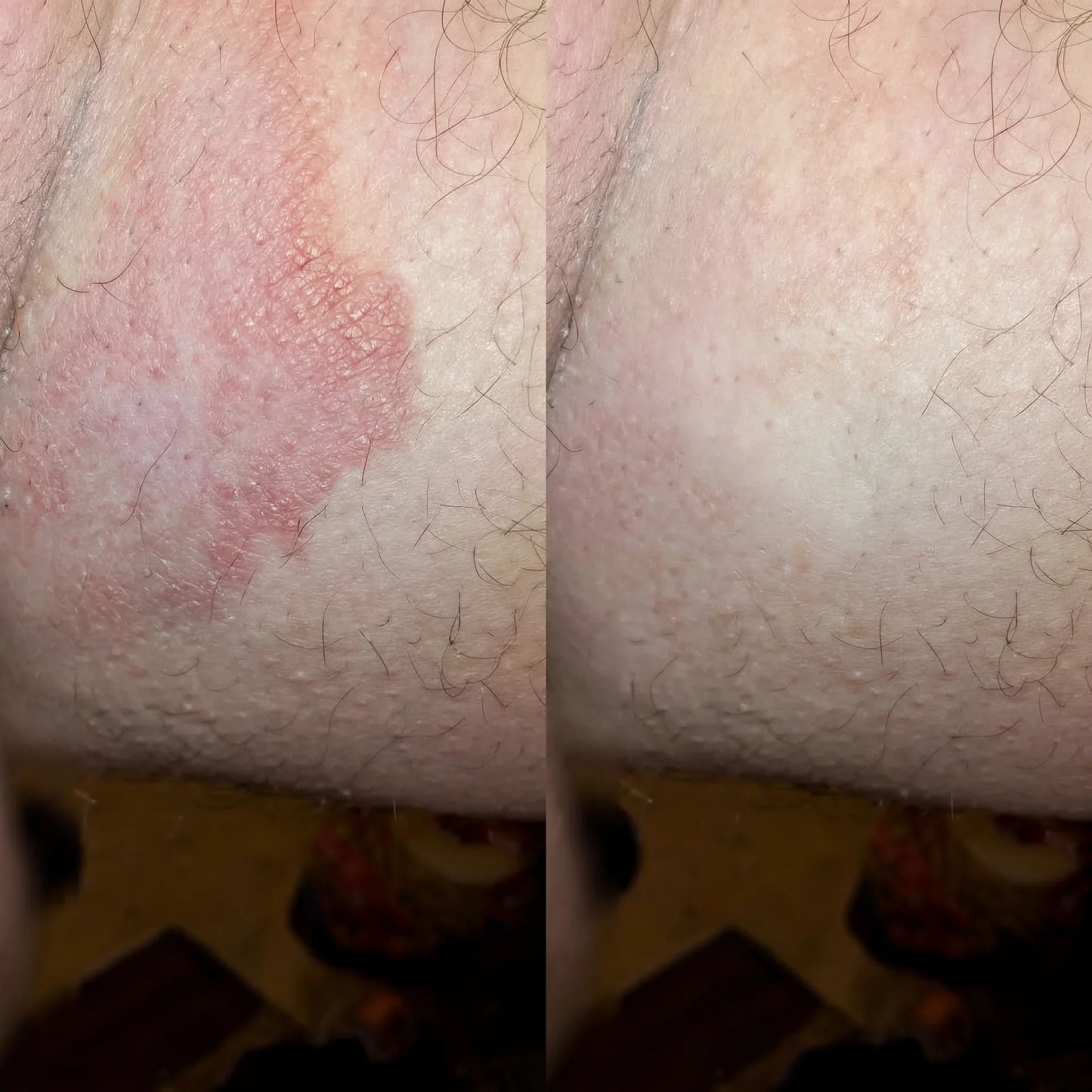 Veloma Antifungal Soap